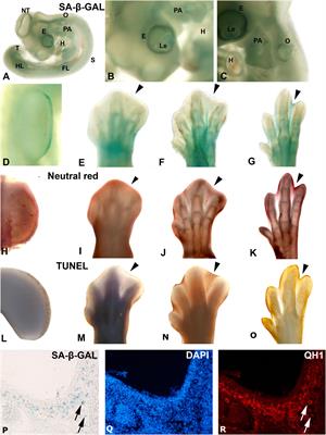 Is Senescence-Associated β-Galactosidase a Reliable in vivo Marker of Cellular Senescence During Embryonic Development?